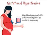 برگزاری آموزش درون بخشی-فشار خون بارداری